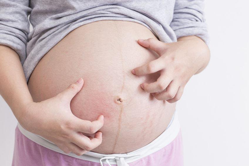 Cách hạn chế ngứa bụng trong thai kỳ