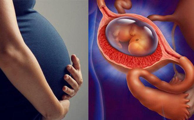 Mang thai ngoài tử cung có thể có con không?