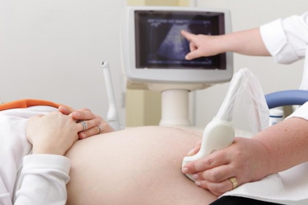 Dư và xoang ối 65mm có ảnh hưởng tới thai nhi không?