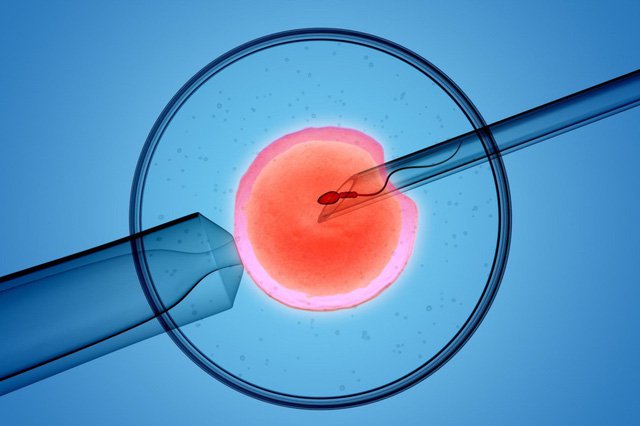 Đã triệt sản nhưng thụ tinh trong ống nghiệm thành công có thể mang thai lại không?