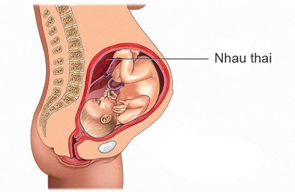 Mang thai 30 tuần bị rau bám thấp kèm đau bụng dưới có sao không?