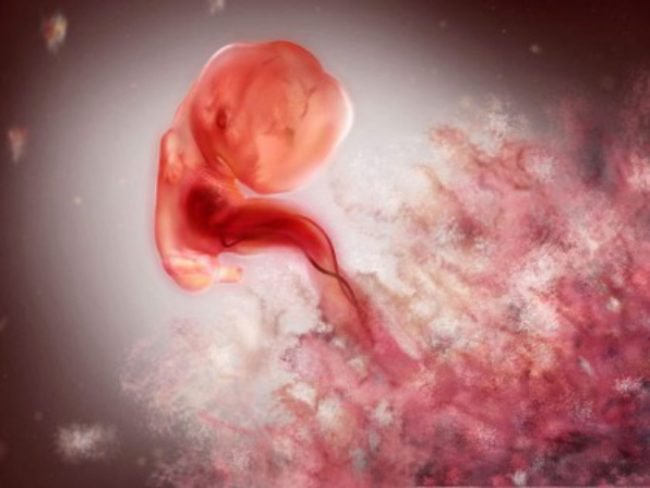 Sảy thai tự nhiên có ảnh hưởng đến lần mang thai tiếp theo không?