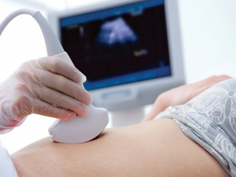 Siêu âm có phát hiện sa tử cung khi mang thai không?