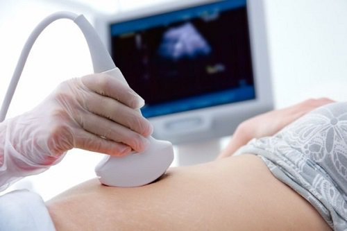 Mang thai 18 tuần siêu âm sỏi có thấy được không?