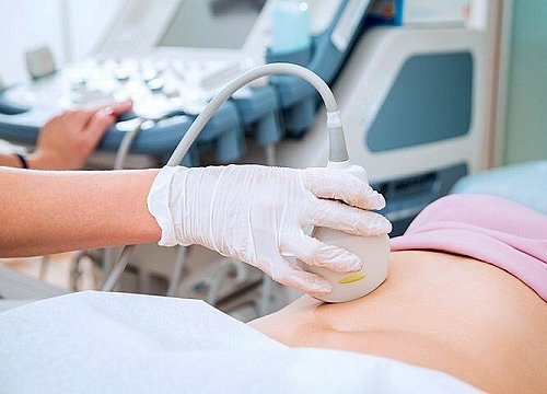 Người có tiền sử tử cung đôi mang thai lần 2 được không?