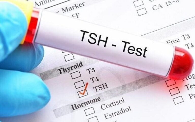 Kết quả xét nghiệm tuyến giáp khi mang thai 16 tuần Free T4 là 1.08; TSH là 0.24l có sao không?