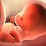 Rau doạ bong, dịch trong buồng tử cung kích thước 52x18mm khi mang thai 10 tuần có nguy hiểm không?