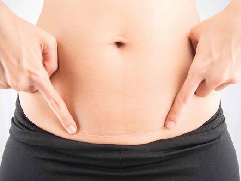 Mang thai lần 3 sau 2 lần sinh mổ có an toàn không?