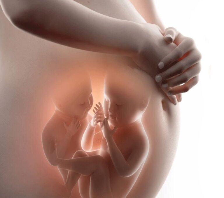 Mang song thai nhưng một thai ngừng phát triển, phải làm sao?