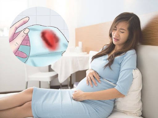 Mang thai 36 tuần bị chảy máu và đau bụng có sao không?