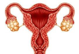 Điều trị đa nang buồng trứng, nội mạc tử cung mỏng để có thai tự nhiên ?