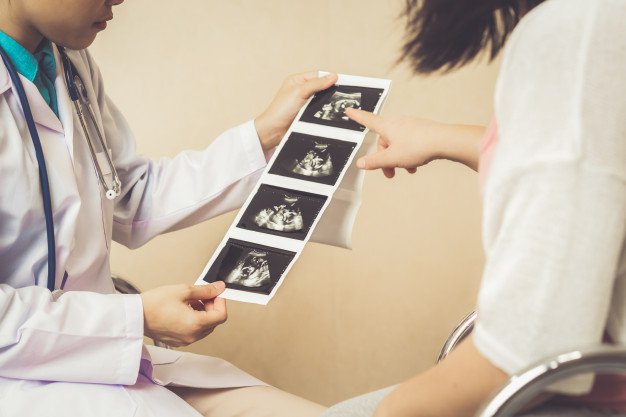 Mang thai 9 tuần xuất hiện 1 phôi và túi thai có khả năng thai đôi không?
