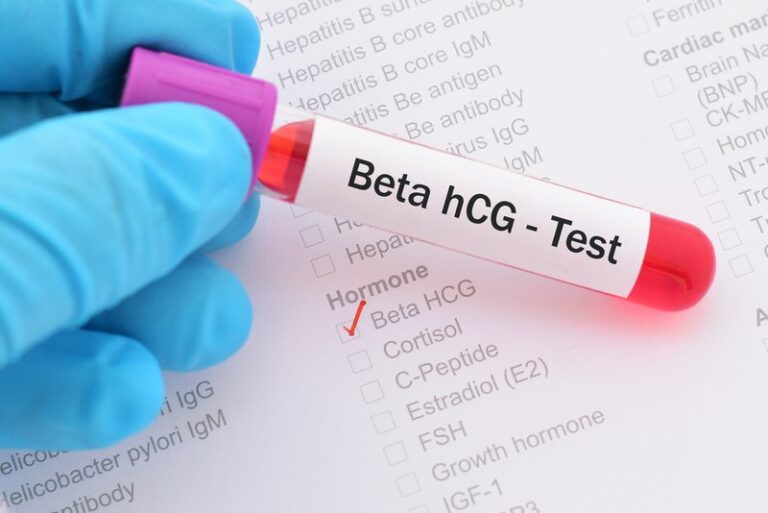 Chậm kinh 1 tuần, thử que 2 vạch, xét nghiệm beta HCG 2960 nhưng siêu âm không thấy túi thai có phải chửa ngoài tử cung không?