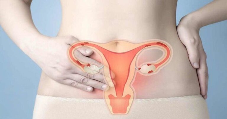 Niêm mạc tử cung mỏng, kinh nguyệt ít phải làm sao để có thai?