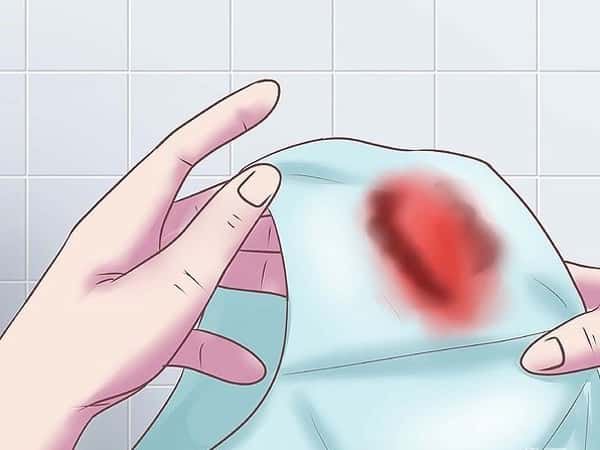 Ra máu trong giai đoạn sớm của thai kỳ có sao không?